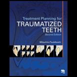 Treatment Planning for Traumatized Teeth