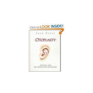 Otoplasty: Aesthetic and Reconstructive Techniques (Singular Textbook) (9783540745945): Jack Davis: Books