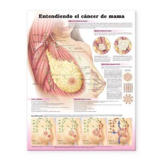 Understanding Breast Cancer Spanish: Entendiendo el cncer de mama (Spanish Edition) (9780781772242): Anatomical Chart Company: Books