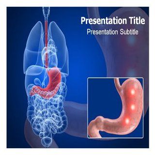 Peptic Ulcer Powerpoint Templates   Peptic Ulcer PowerPoint Background   Peptic Ulcer (PPT) Slides: Software