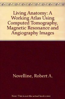 Living Anatomy: A Working Atlas Using Computed Tomography, Magnetic Resonance and Angiography Images: 9780801647468: Science & Mathematics Books @