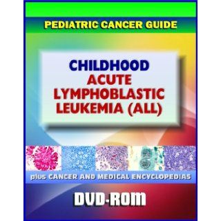 Childhood Acute Lymphoblastic Leukemia (ALL): Pediatric Cancer Guide to Causes, Signs and Symptoms, Testing and Diagnosis, Treatment Options, Prognosis, Clinical Trials and Research (DVD ROM): Medical Ventures Press: 9781422054062: Books