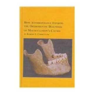 How Anthropology Informs the Orthodontic Diagnosis of Malocclusion's Causes (Mellen Studies in Anthropology, 1): 9780773479807: Medicine & Health Science Books @