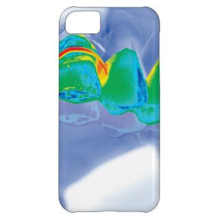 Stylish iPhone 5 case for dentists!