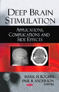 Deep Brain Stimulation: Applications, Complications and Side Effects (9781606928950): Mark H. Rogers, Paul B. Anderson: Books